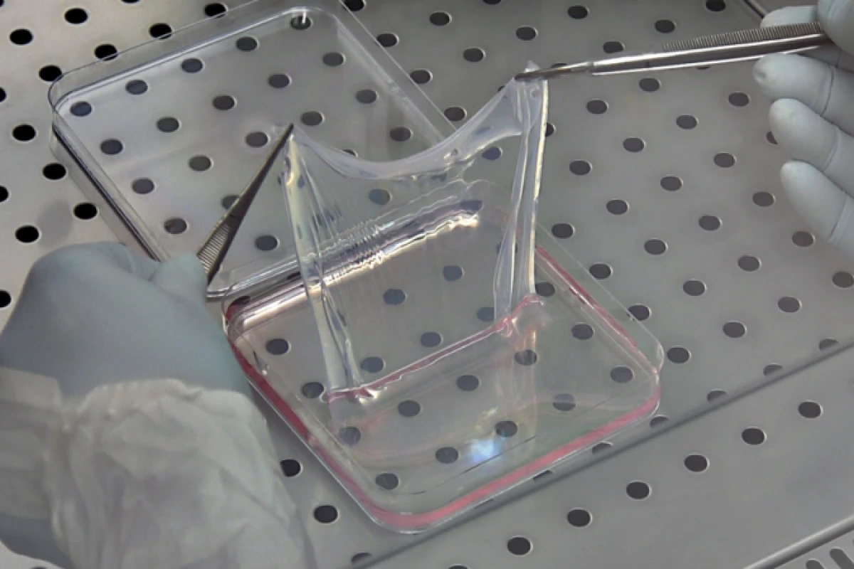 The genetically modified, laboratory-grown skin that saved a young boy's life