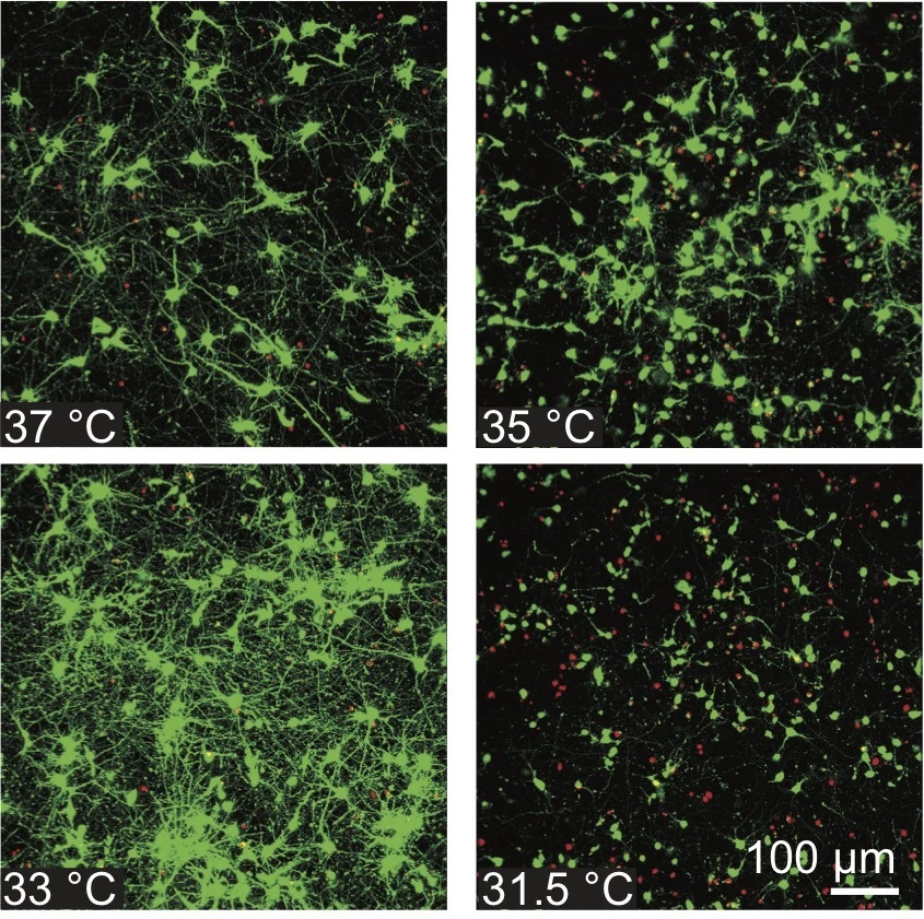 The researchers found cooling the concussed brain cells to 33 °C was optimal for maintain healthy function, as seen in green