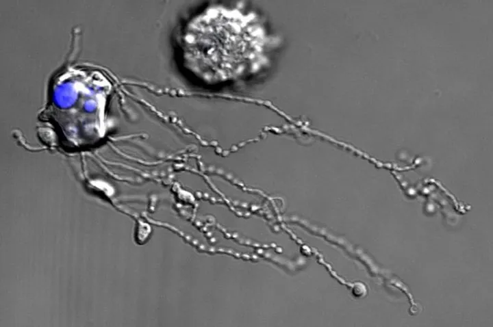 The first-of-its-kind video shows the white blood cells to eject a string of proteins as they die