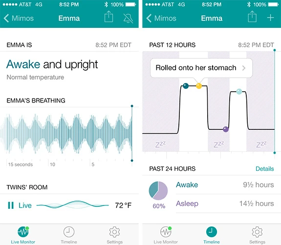 Mimo Baby Monitor's smartphone app interface