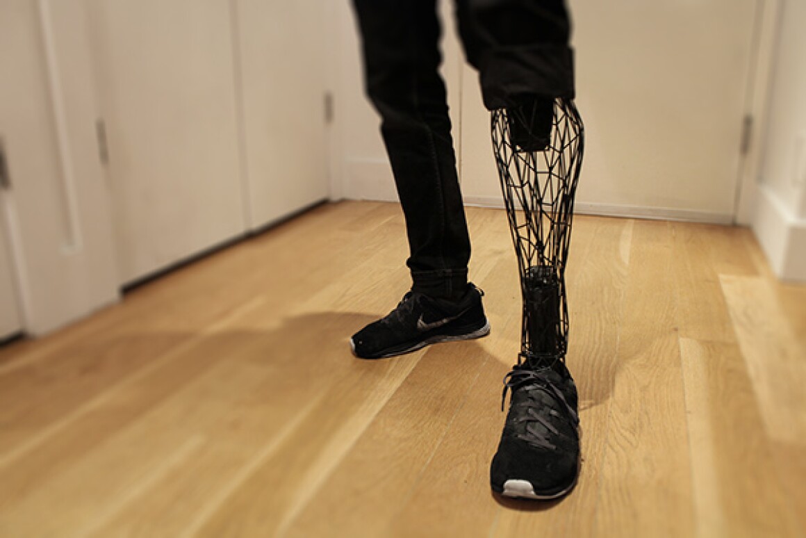 3D printed Exo-Prosthetic leg designed to be affordable ...