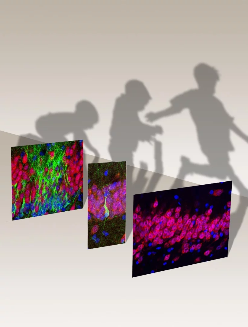 Young neurons (green) decrease in the human hippocampus across the lifespan, vs more mature neurons (red)