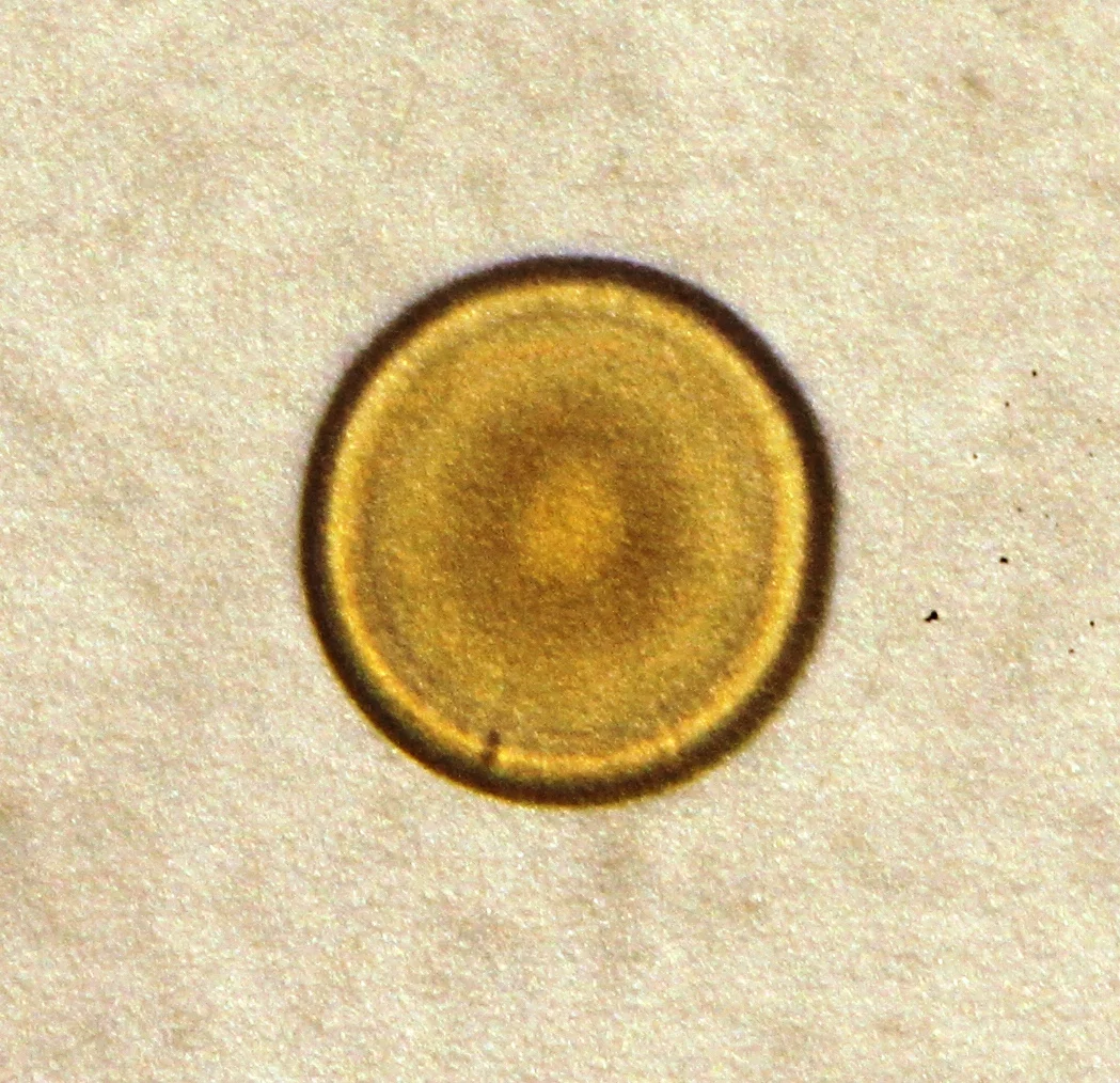 The colonies were grown in Plate Count Agar (PCA) for three days (Photo: BMS1035 Practical and Biomedical Bacteriology/University of Surrey)