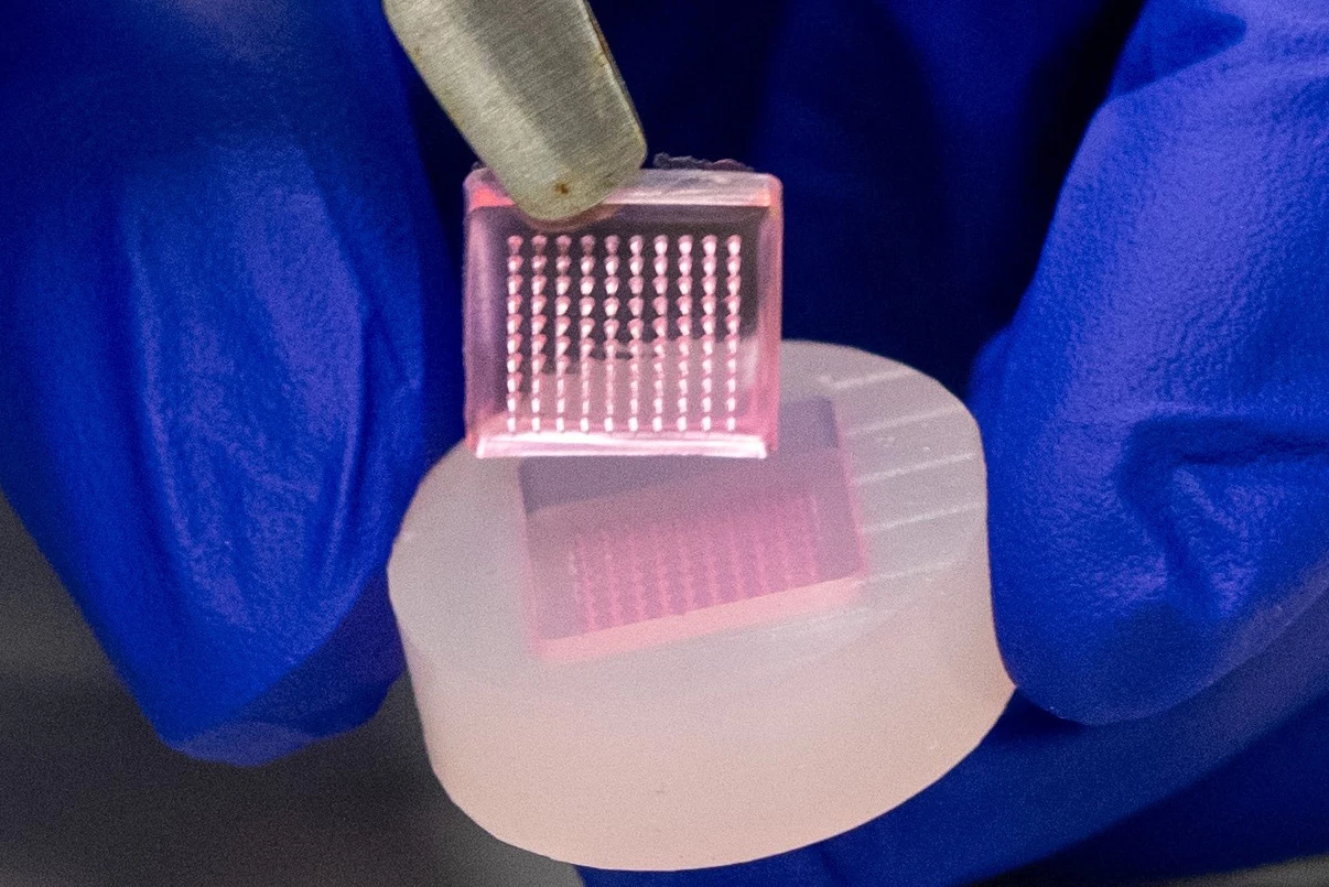 These tiny needles could be the key to treating chronic wounds that many diabetics suffer from – and help them avoid amputations