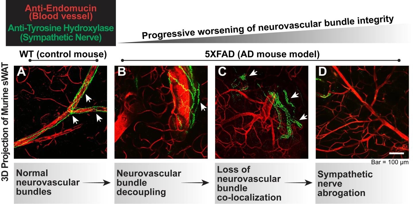 This image shows the decoupling of nerves and blood vessels caused by Alzheimer's disease