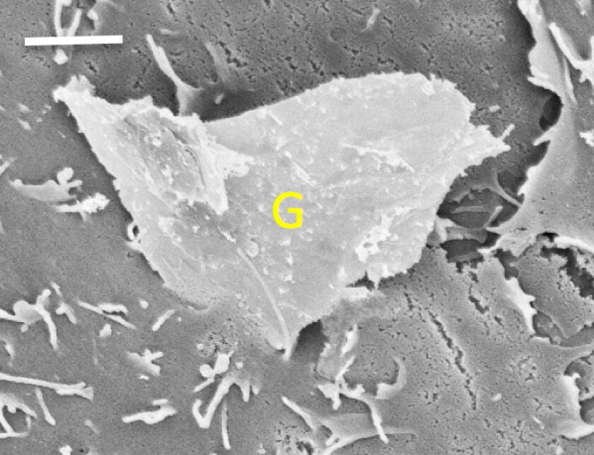 The bottom corner of a piece of graphene penetrates a cell membrane - mechanical properties like rough edges and sharp corners can make graphene dangerous to human cells. Scale bar represents two microns. (Image: Kane lab/Brown University)