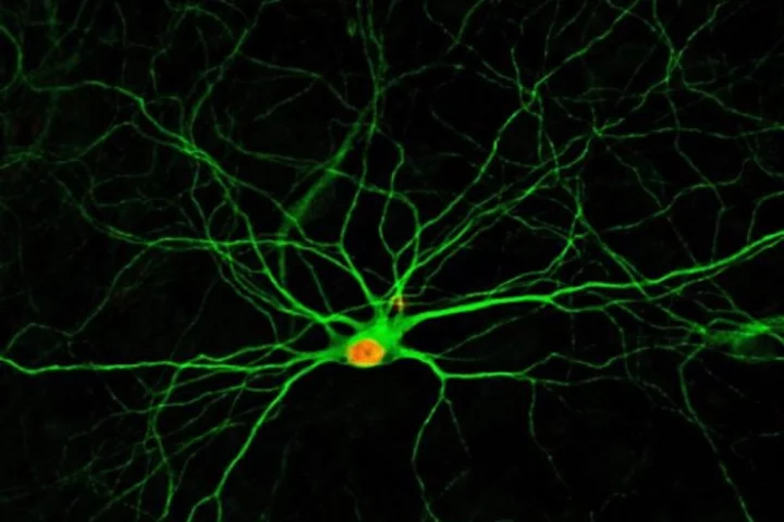 New neurons, four months after being converted from glial cells thanks to a chemical formula developed at Penn State