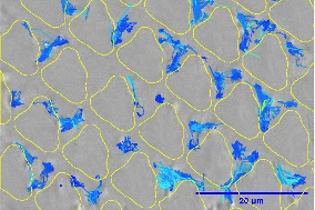 Two hours after the earlier image was recorded, the trapped bacterial cells started producing a lubricating substance which blocked subsequent biofilm formation