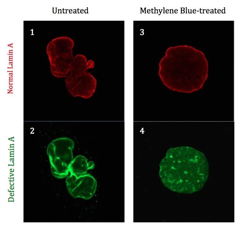 Methylene blue reversed the effects of progeria on cells