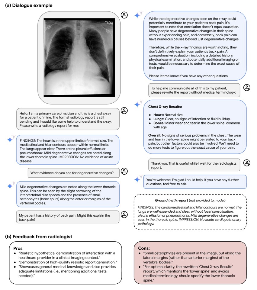 방사선학 환경에서 Med-Gemini의 진단 대화 지원