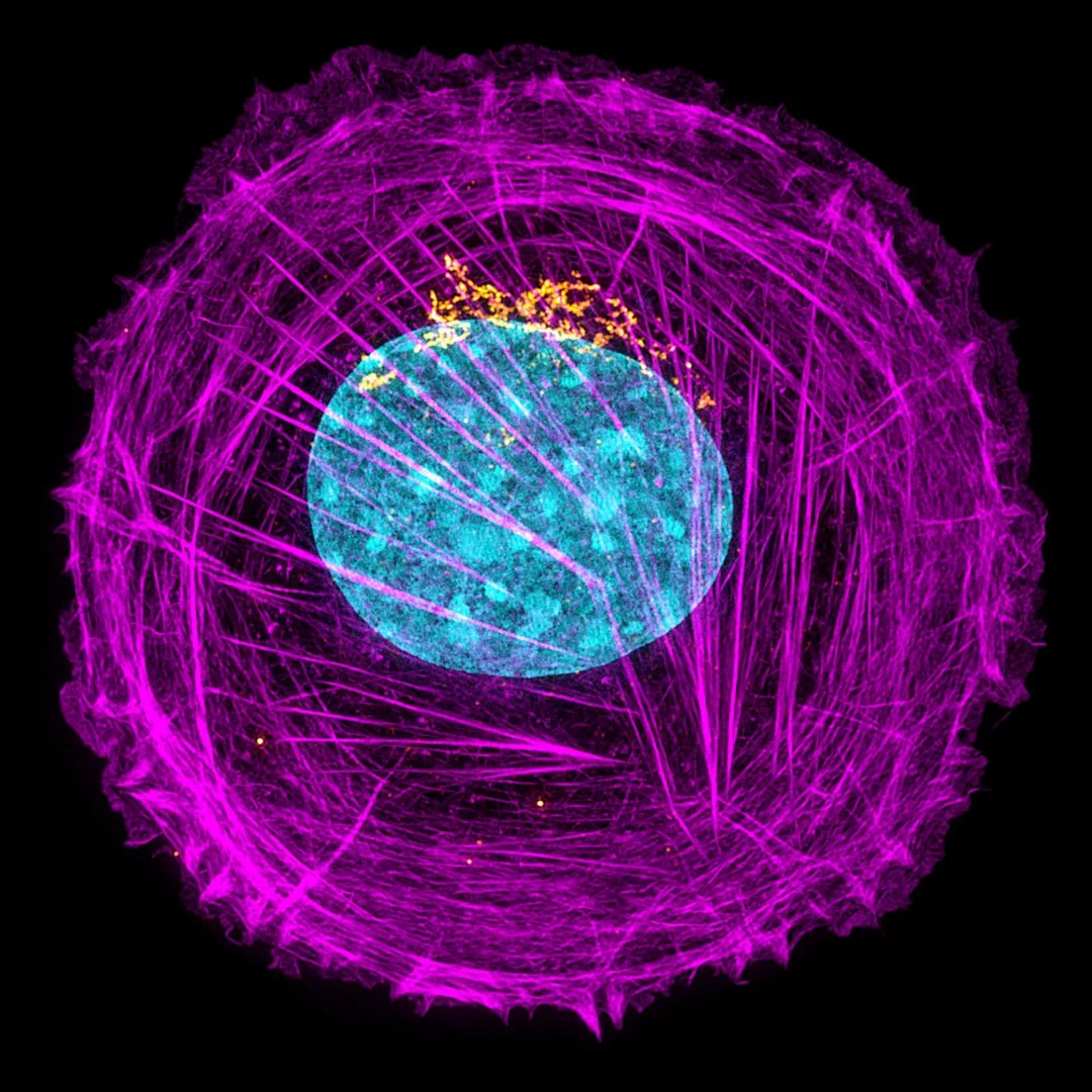 Image of Distinction: Mouse embryonic fibroblast cell stained for actin (magenta), golgi (orange) and nucleus (blue)
