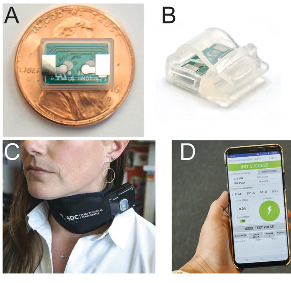 The implantable pulse generator (IPG), shown on a penny for scale (A), is fitted into a silicone cuff (B) – It's implanted on the left cervical vagus nerve in a soft cloth collar (C), and is controlled by a therapist via a connected mobile app (D)