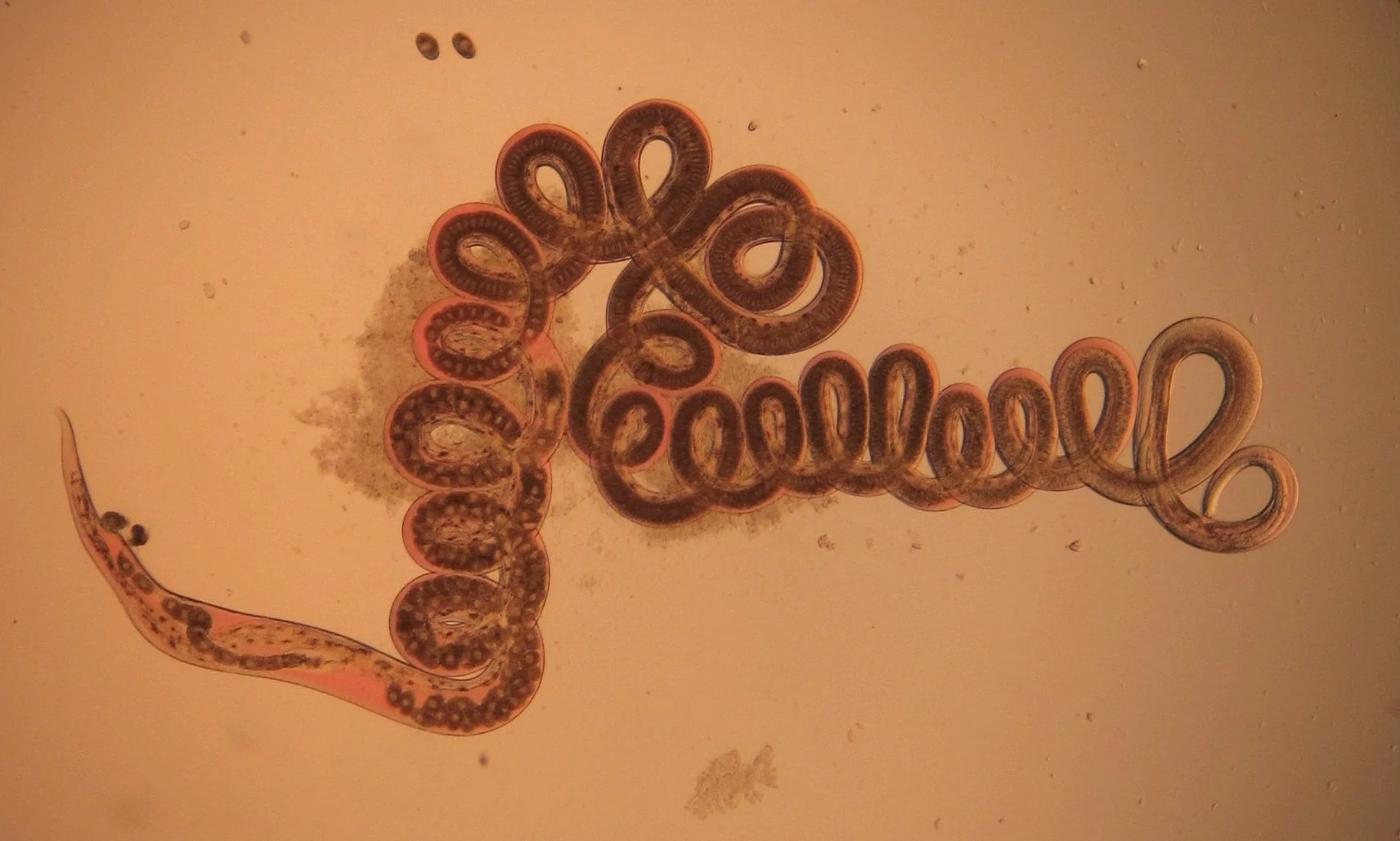 This parasitic worm, Heligmosomoides polygyrus, has been found to reduce incidences of obesity in mouse experiments