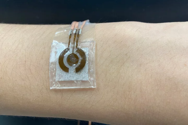 The prototype glucose-monitoring sensor, adhered to a volunteer's arm