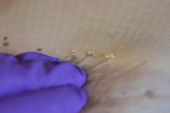 The "jelly" seen on the skin of a skate