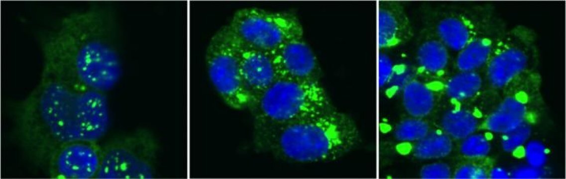 A single tau monomer encodes different assembly conformations that each leads to distinct patterns of pathology