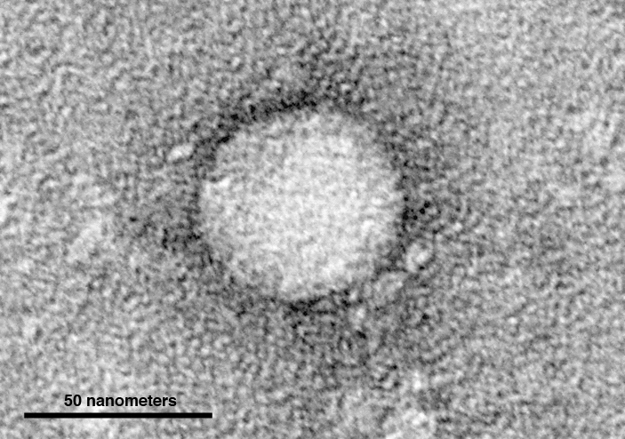 Electron micrographs of hepatitis C virus purified from cell culture