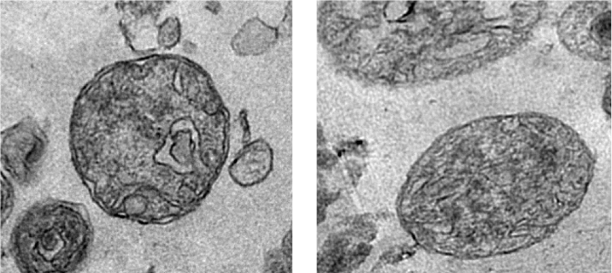 Microscope images of the structures containing fully-functioning mitochondria, which were discovered in the bloodstream for the first time
