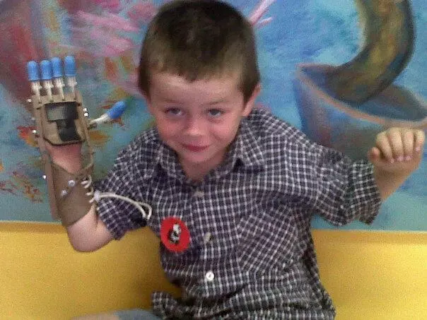 Liam impressed his doctors and classmates alike with his "Robohand," which was created by Ivan Owen and Richard Van As