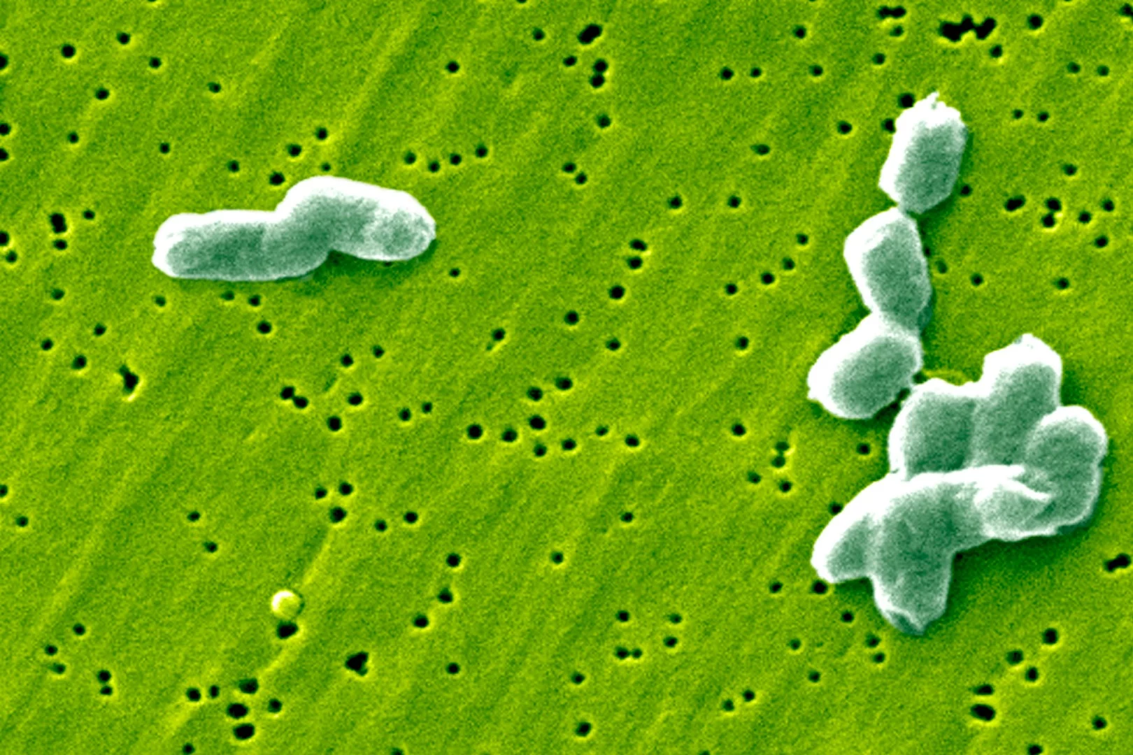 A specific type of gut bacteria has been found to produce a compound that inhibits the ability of Salmonella to replicate inside the stomach