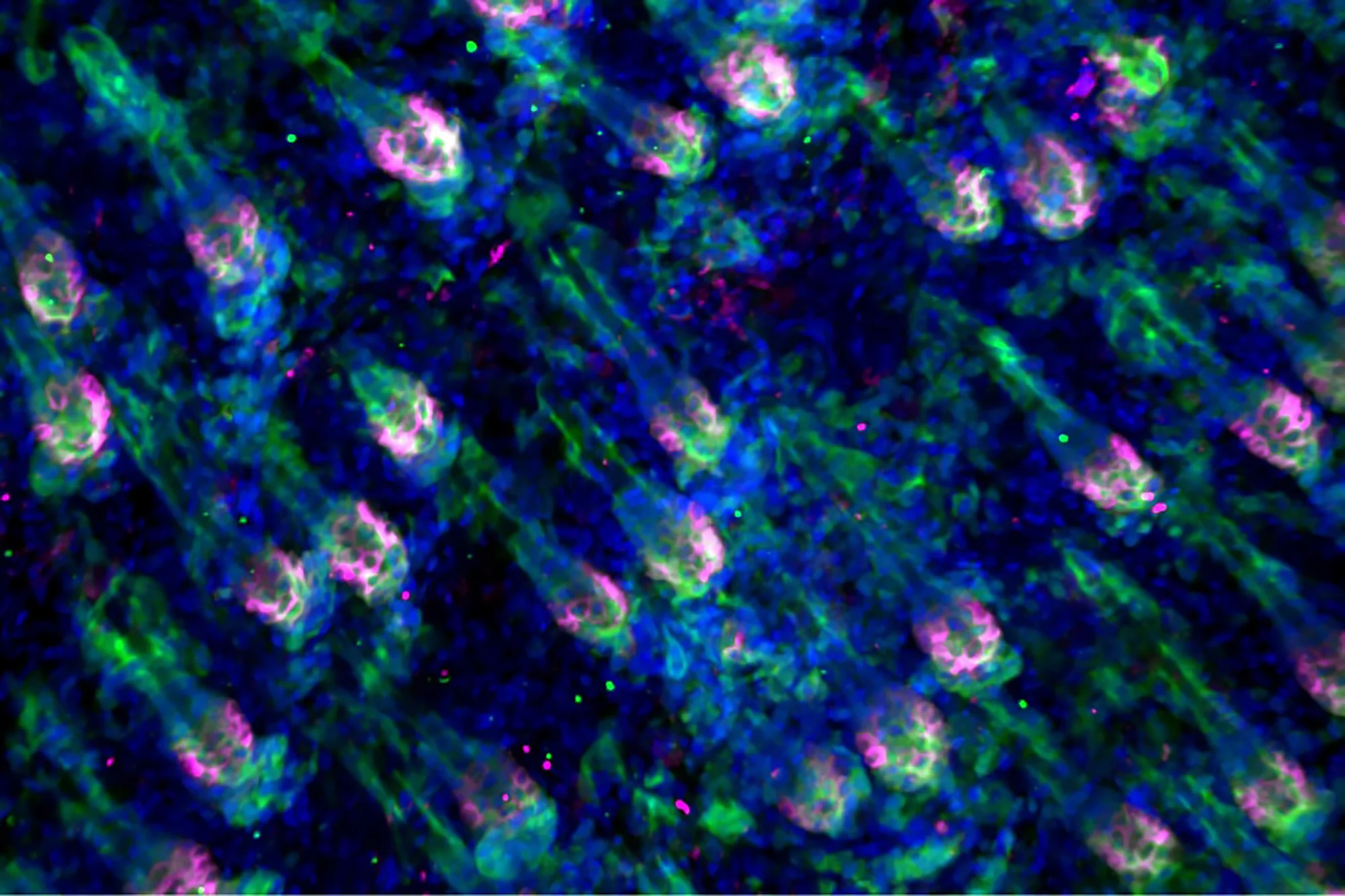 Hair follicles in the early stages of regrowth