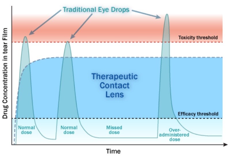 "Our lenses offer the increased efficacy and efficiency of drug delivery, which translates to better eye health." (Image: Auburn University)