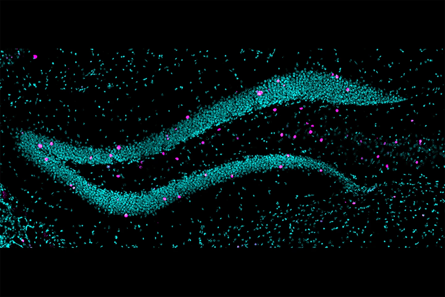 Dense bands of neurons (stained teal) in the two blades of the vDG. Cells stained pink were overactivated when the mouse entered a threatening environment, indicating avoidance behavior and heightened anxiety
