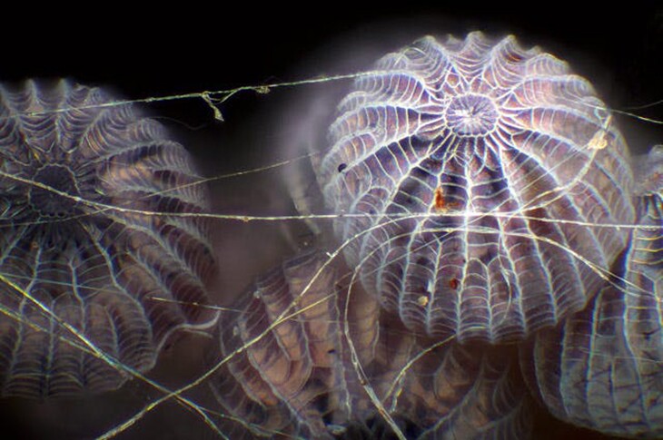 Closeup of moth eggs in spider silk, a submission to the Nikon Small World Photomicrography Competition