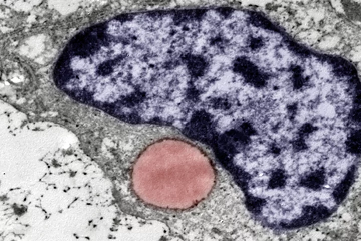 A new type of cartilage-like tissue made up of these fat-containing cells has been discovered