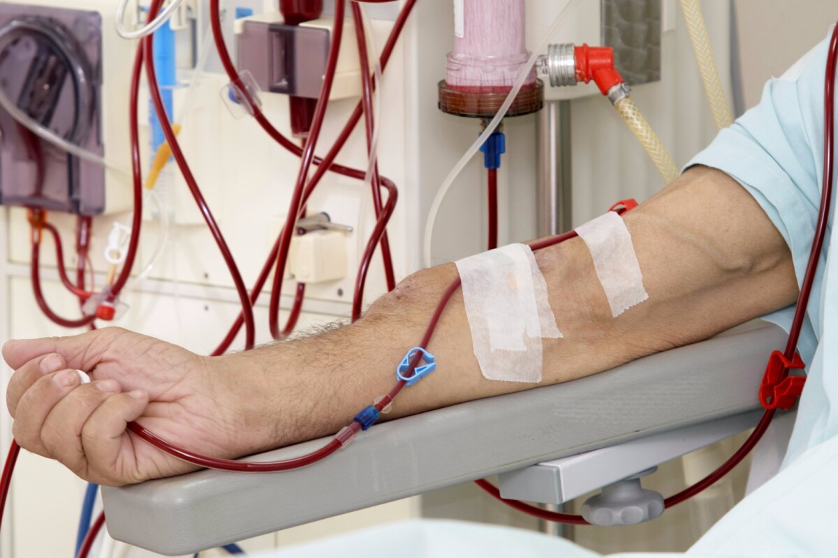 Graphenebased dialysis membrane filters 10 times faster than current