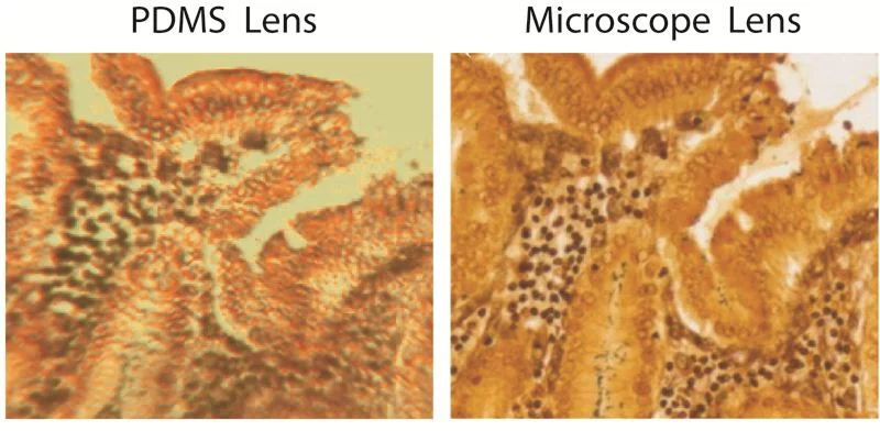 Comparison of a human tissue sample between the 1-cent PDMS lens (left) and a $300 microscope lens (right)