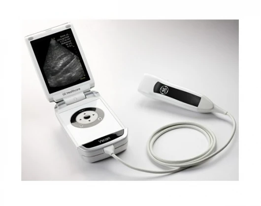 General Electric's new Vscan portable ultrasound scanner, possibly giving every physician Star Trek-like diagnostic capabilities