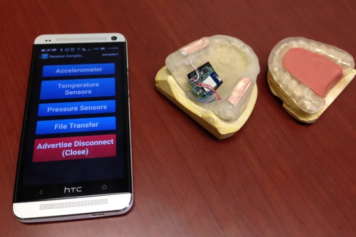The prototype bruxism-detecting mouth guard, and its app