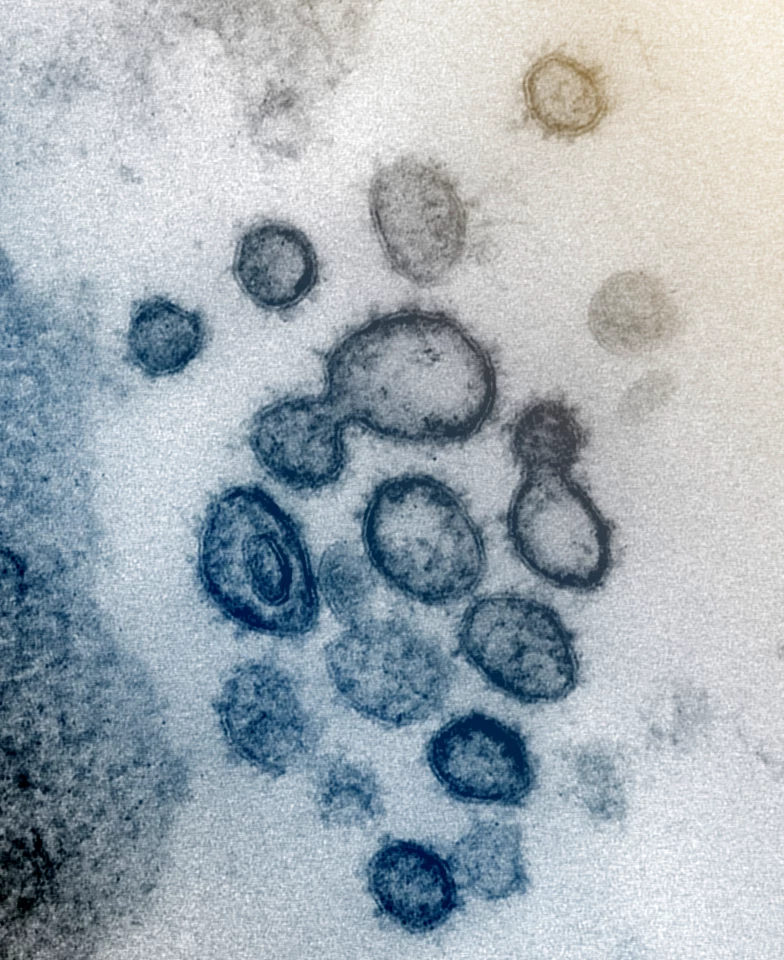 Virus particles are shown emerging from the surface of cells cultured in the lab