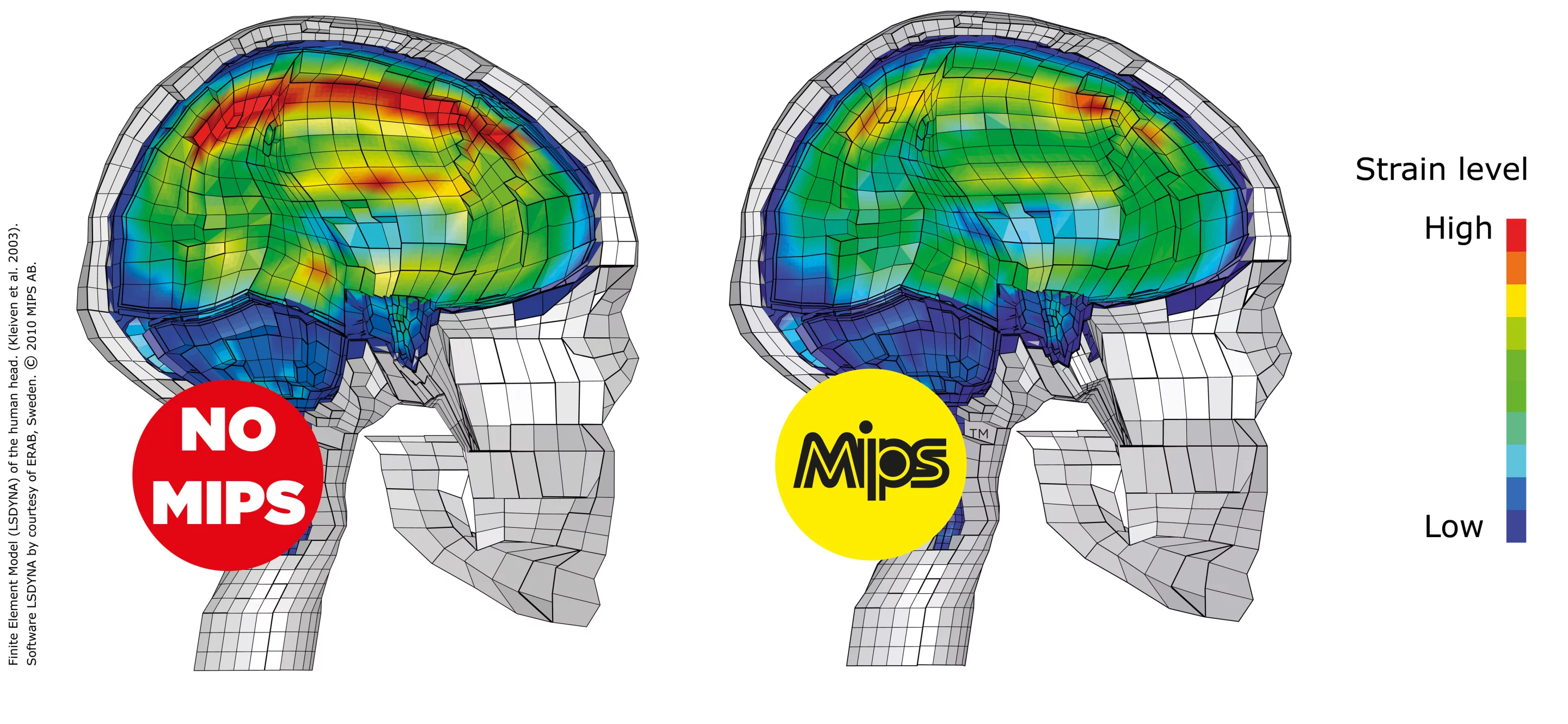 MIPS is designed to decrease forces on the brain during oblique impacts