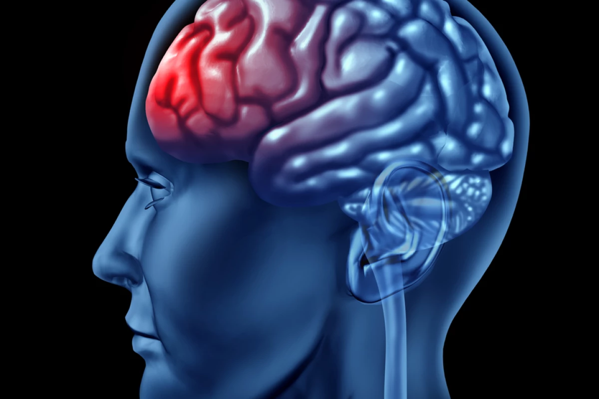The US Army and the US National Football League are cooperating on a project to develop better ways of preventing concussion (Image via Shutterstock)