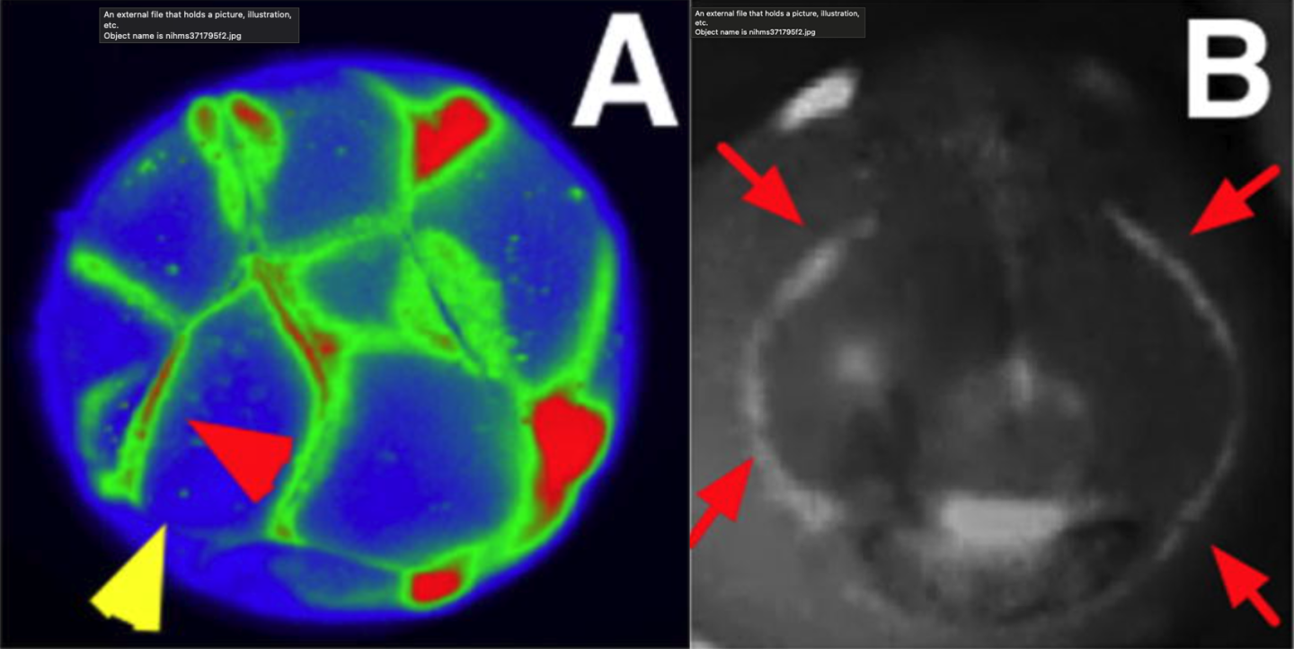 A: Voltage-reporter dyes show electrical gradients in a frog embryo at just 16 cells. B: Isopotential cell fields show hyperpolarized areas that presage the expression of regulatory genes during a frog embro's cranio-facial development