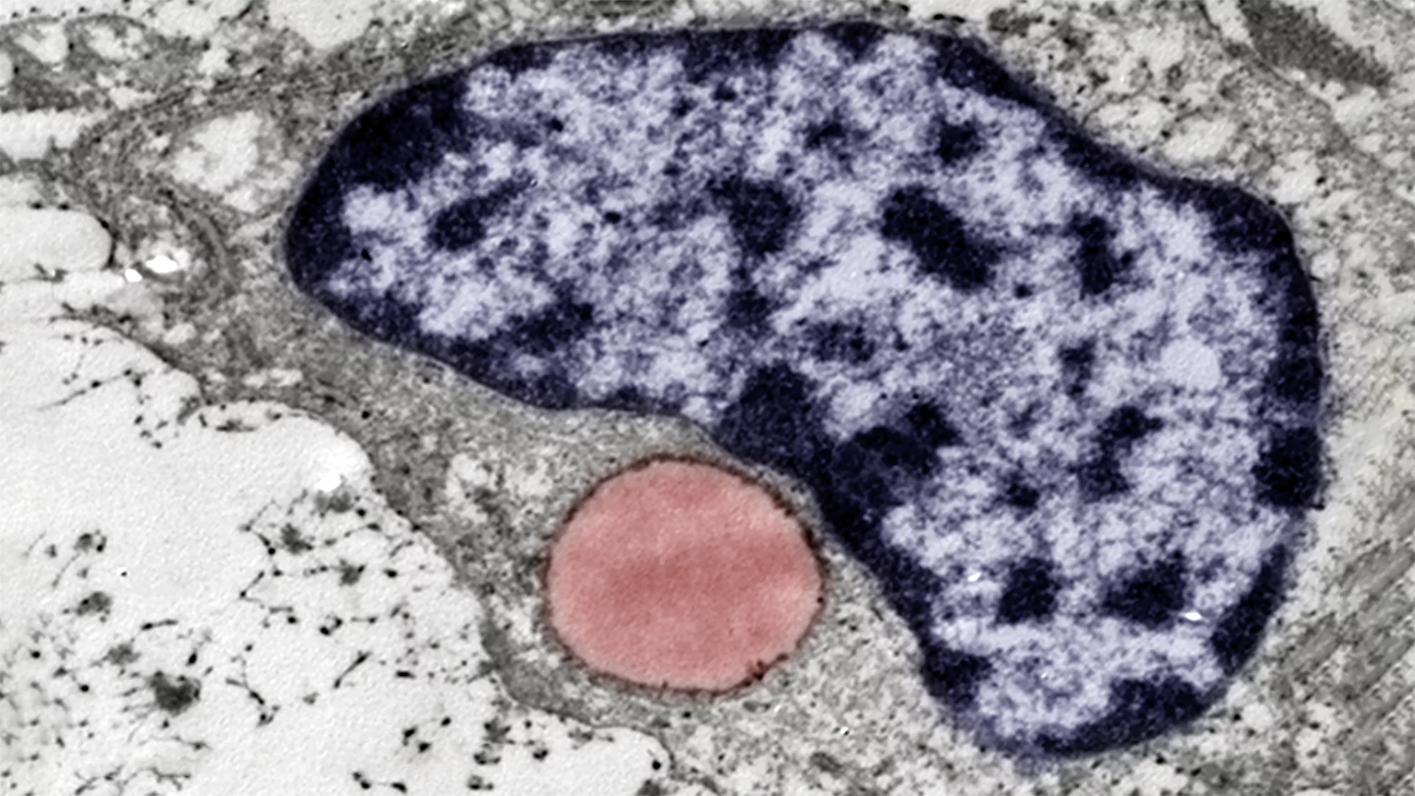 A new type of cartilage-like tissue made up of these fat-containing cells has been discovered