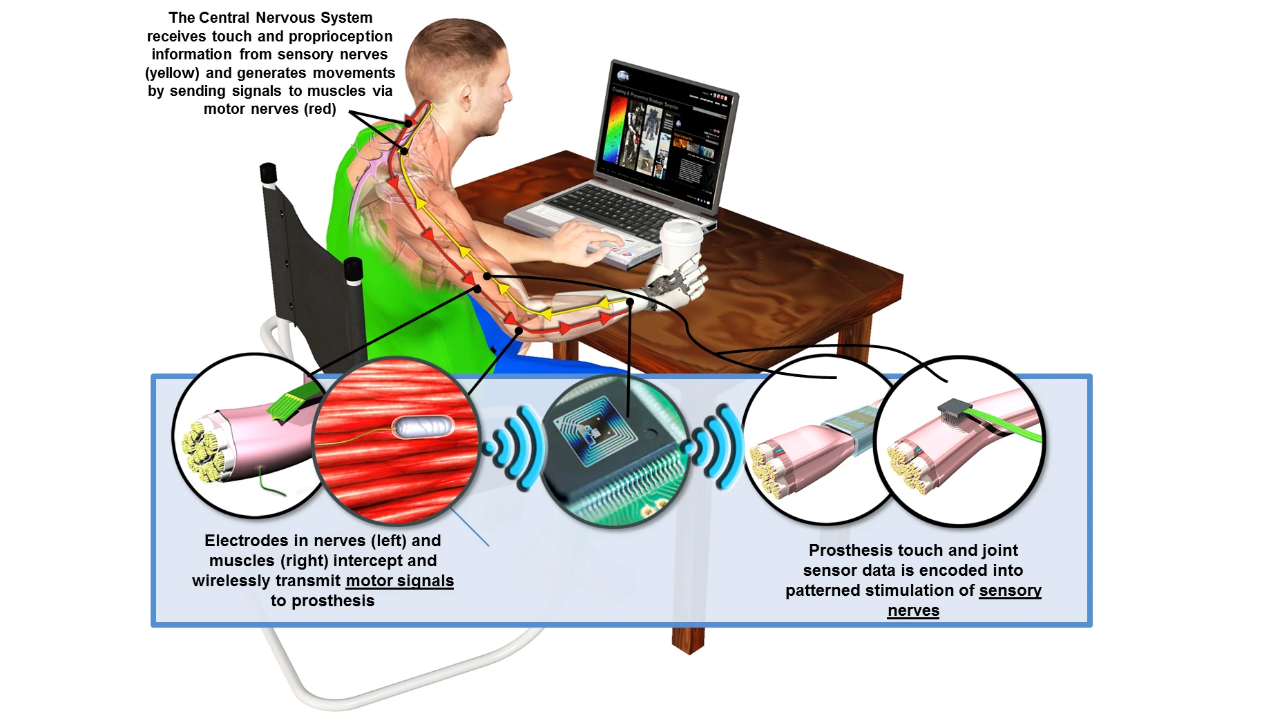 Using implantable sensors linked wirelessly to external modules, the goal is to provide lifelike prosthetic limbs with a high degree of sensory feedback
