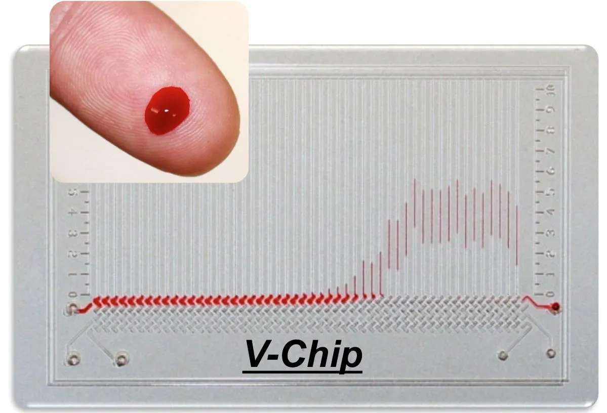 The V-chip is an inexpensive credit card-sized device, that can instantly test a single drop of blood for up to 50 different substances