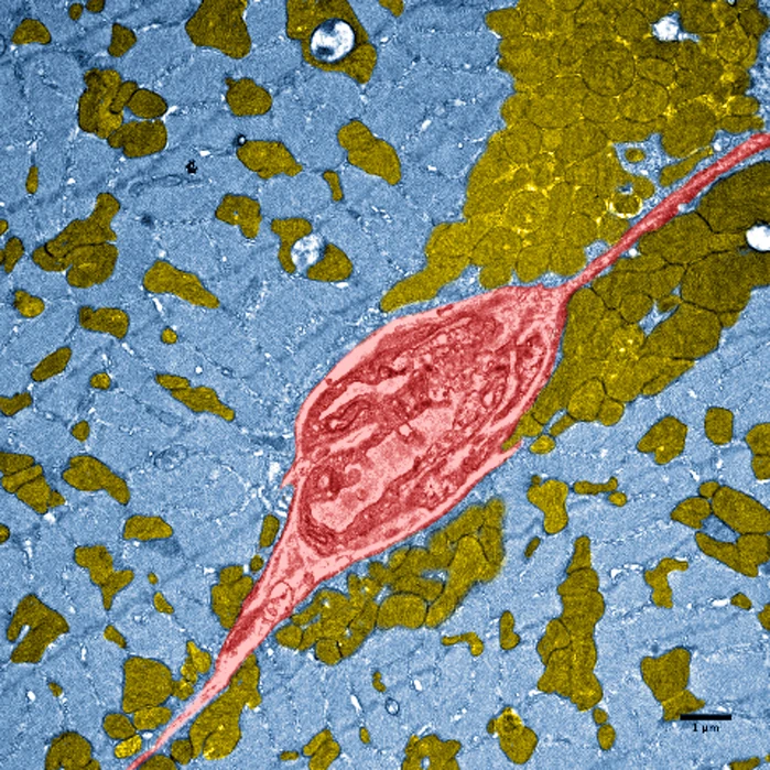 Pumped-up muscle tissue (in blue) in a high performing "mighty mouse"