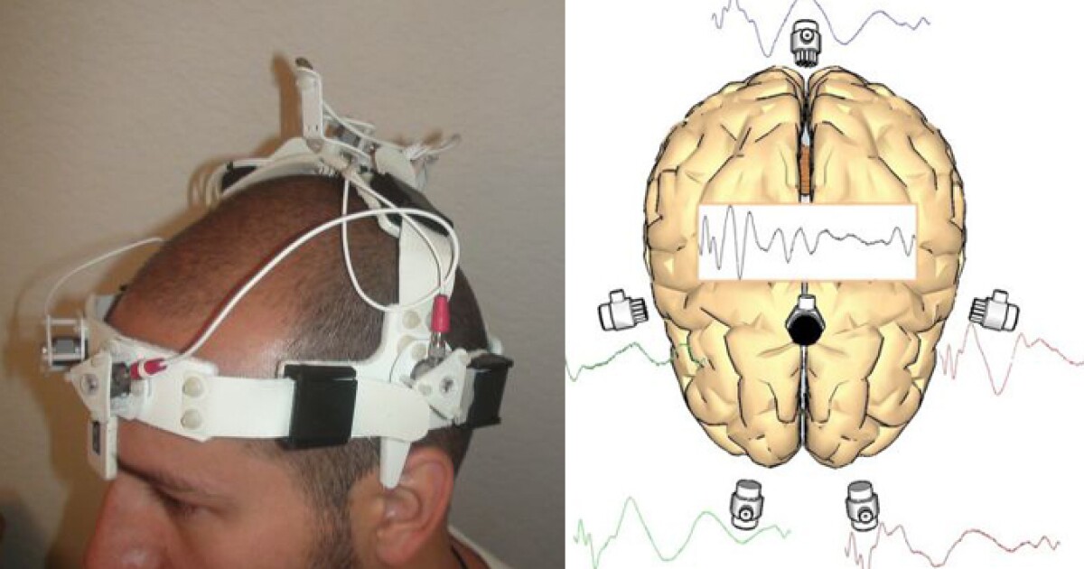 Headworn device uses sonar to rapidly diagnose stroke