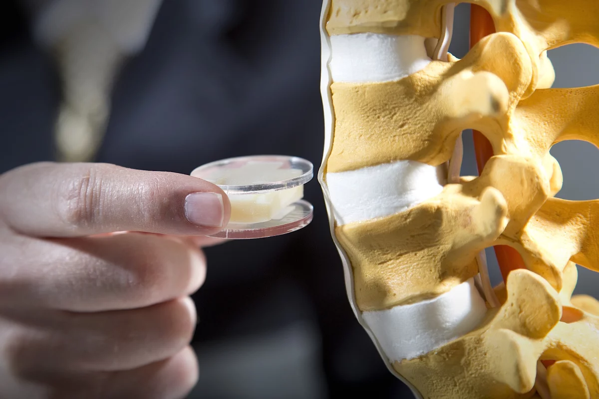 A prototype of the BYU artificial spine disc replacement