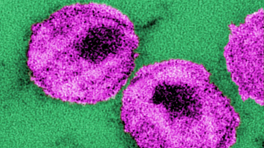 A number of HIV particles, or virions that could be targeted and killed using engineered human blood stem cells (Photo: CDC/ Dr. A. Harrison; Dr. P. Feorino)