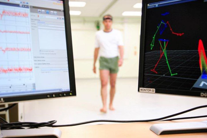 A new study suggests a person's gait can be used to distinguish between Alzheimer's dementia and Lewy body dementia