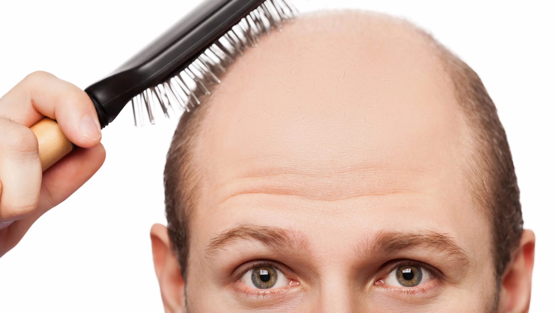 A small study is claiming premature graying and hair loss could signal an increased risk of heart disease