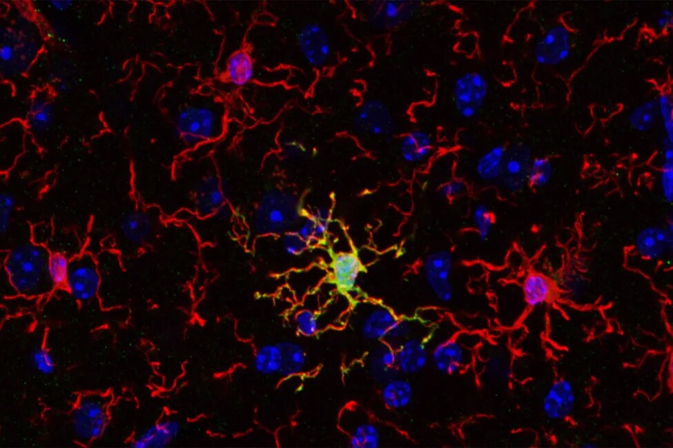 Researchers have identified a subset of microglia, the brain's immune cells, called ARG1+ microglia (shown here in yellow), surrounded by regular microglia (red)