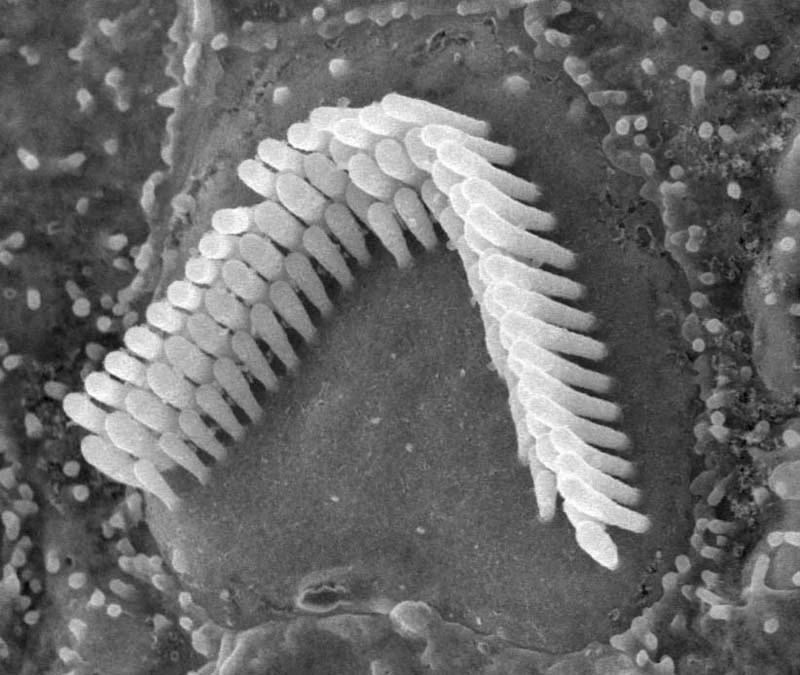 Hair cells like these have been successfully recreated in a petri dish (Photo: CC)