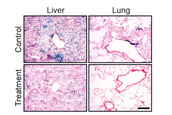 The blue staining shows senescent cells in lung and liver tissue. The amount of the staining is significantly reduced following the drug treatment