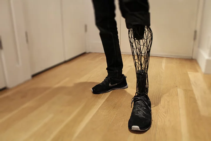 Rather than have a robotic feel, the Exo adds a more lifelike dimension to prosthetics (Photo: Will Root)